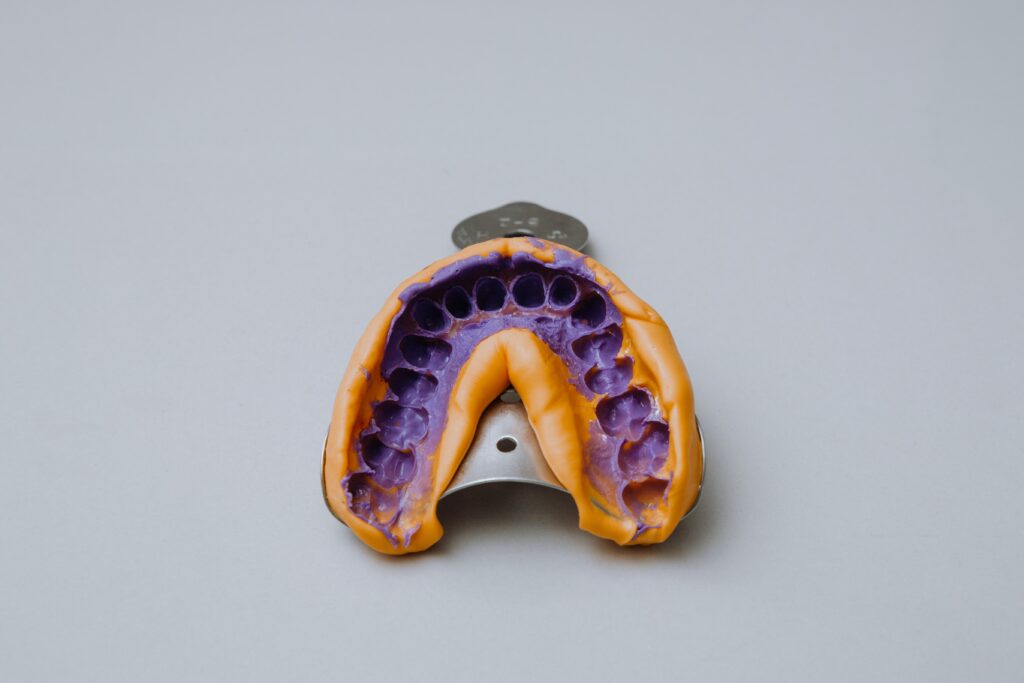 Alginate impression of teeth on impression tray