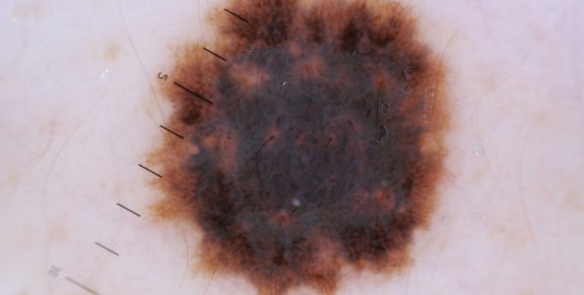 dermatologist Mission Viejo CA